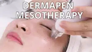 Mesotherapy & Dermapen